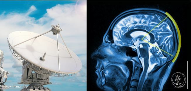 Satellitenschüssel und Röntgenaufnahme Schädel